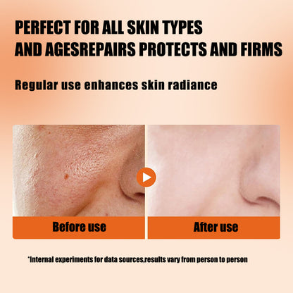 Huda Beauty Vatamin C+ Facial Serum for All Skin Types - Dermatologist Tested - Anti-Aging & Dark Spot Remover - Brightening, Clean Beauty, Cruelty-Free